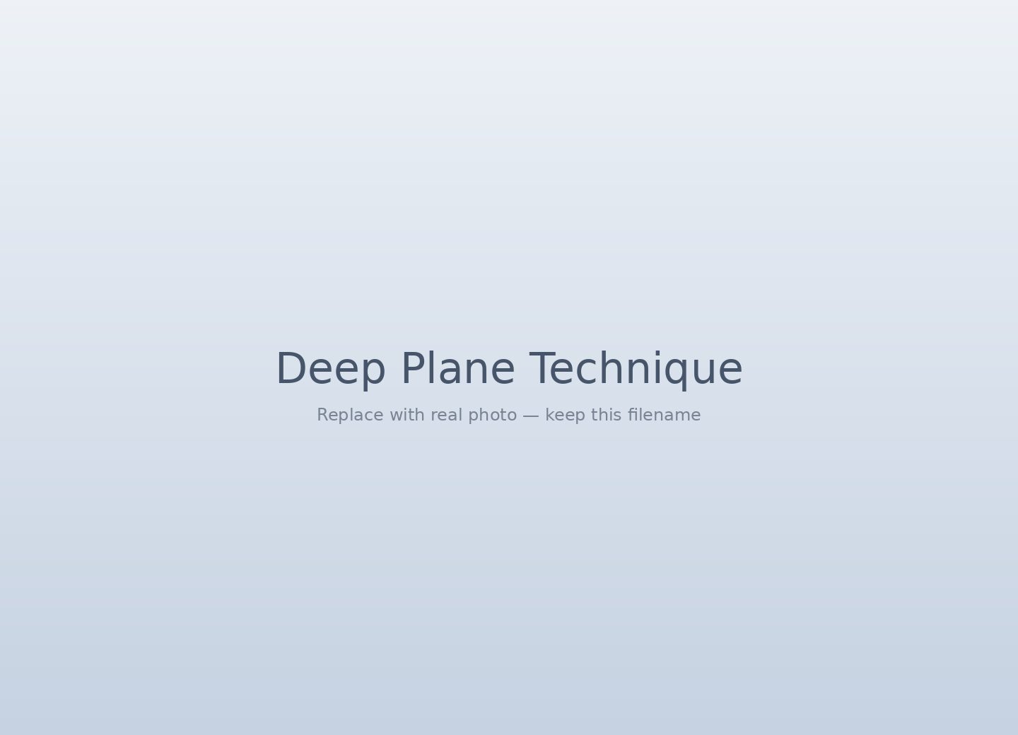 Deep plane facelift technique diagram — SMAS layer repositioning