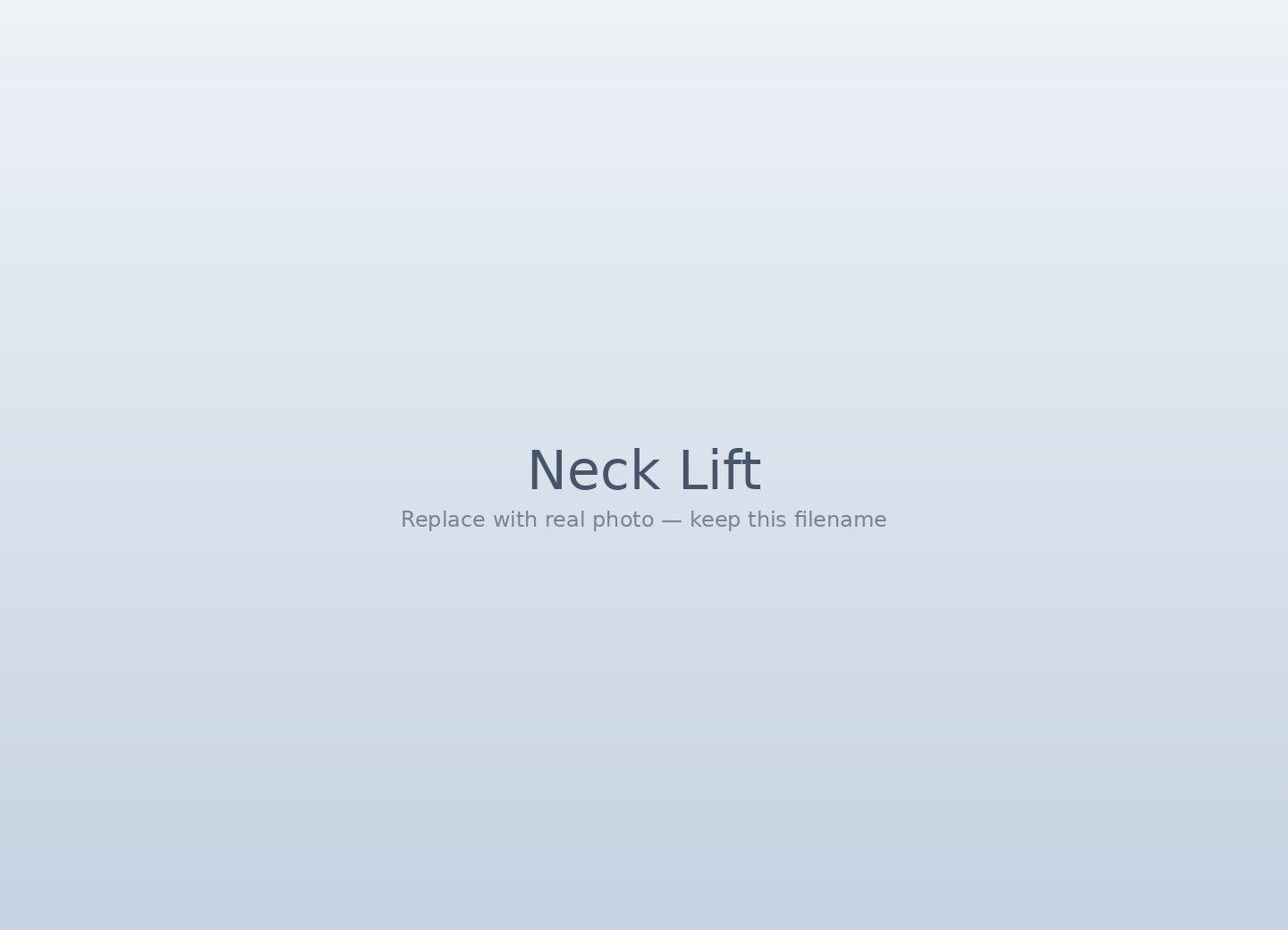 Neck lift in Tijuana — deep plane platysma repair for jawline definition